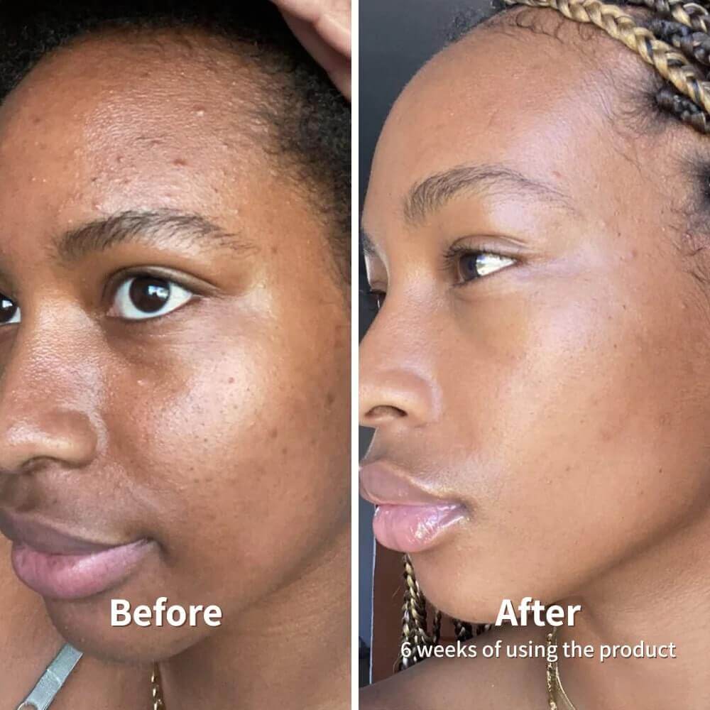 Dr. Melaxin K-Beauty Rice Peel™️