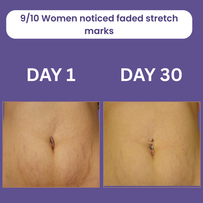 Liorax™️ Overnight Tummy Toning Cream