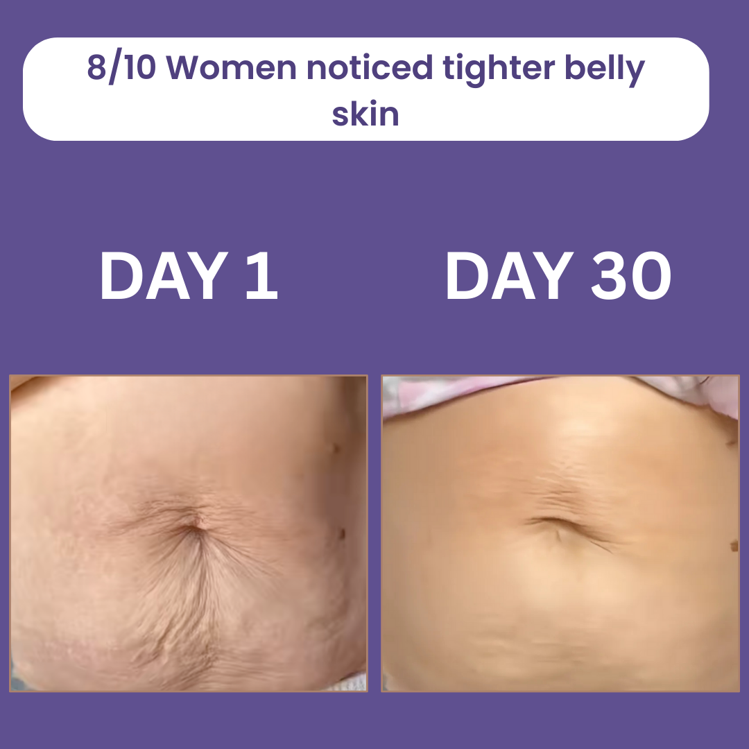 Liorax™️ Overnight Tummy Toning Cream
